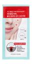 Holika Holika AC Mild Red Spot Patch Holika Holika AC Mild Red Spot Patch