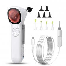 LYNSUM Портативный отоскоп 720P LYNSUM Портативный отоскоп 720P