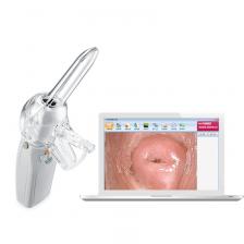 Портативный цифровой видео электронный мини-кольпоскоп FA2 с камерой 3000000 пикселей, эндоскоп, гинекология, самообнаружение Dr.SHE Портативный цифровой видео электронный мини-кольпоскоп FA2 с камерой 3000000 пикселей, эндоскоп, гинекология, самообнаружение Dr.SHE