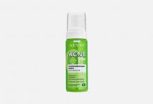 пенка успокаивающая для умывания ACNEKILLER 150 мл AEVIT BY LIBREDERM