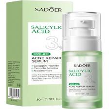 SADOER Сыворотка для лица против акне с салициловой кислотой 30
