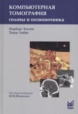 Литература Книга Хостен Н., Либиг Т.; Пер. с нем.; Под общ. ред. Ш.Ш. Шотемора. Компьютерная томография головы и позвоночника