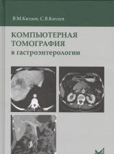 Литература Книга Китаев Вячеслав Михайлович, Китаев Сергей Вячеславович. Компьютерная томография в гастроэнтерологии 9785000303184