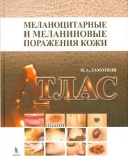 Литература Книга Ламоткин Игорь Анатольевич. Меланоцитарные и меланиновые поражения кожи. Учебное пособие