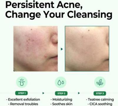 Очищающее мыло "Чудо" 30 дней кислоты Aha Bha и Pha 160 г Smi-26079 – фото 6