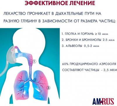 AMNB-501 – фото 4