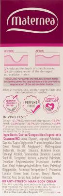 Крем от растяжек "Anti-Stretch Marks Body Cream", 150 мл – фото 9