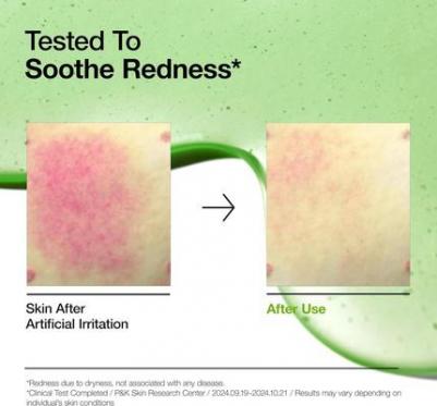 Азелаиновая кислота 10% Гиалуроновая успокаивающая сыворотка для лица с покраснениями для чувствительной кожи – фото 3