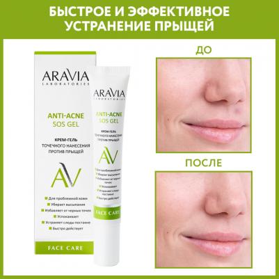 Крем-гель точечного нанесения против прыщей Anti-Acne SOS Gel, 20 мл – фото 2