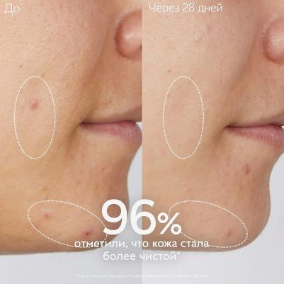Очищающий гель для умывания Vinopure Purifying 75 мл – фото 5
