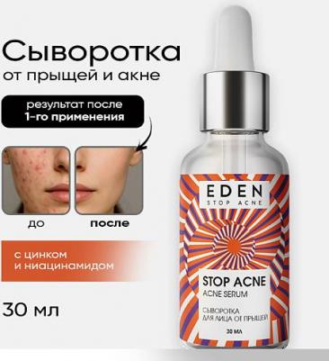 Сыворотка для лица от прыщей Stop Acne 30 мл – фото 1