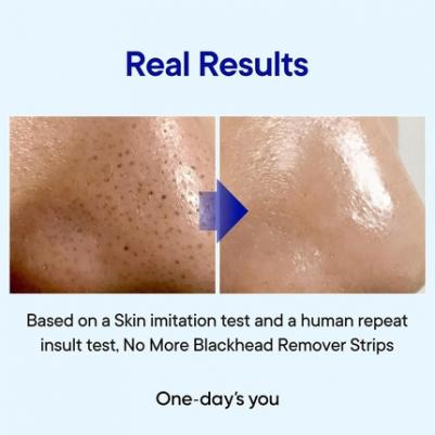 One-day's you Сыворотка от черных точек и угрей / P.Z Ssoc Ssoc No More Blackhead, 100 мл – фото 2