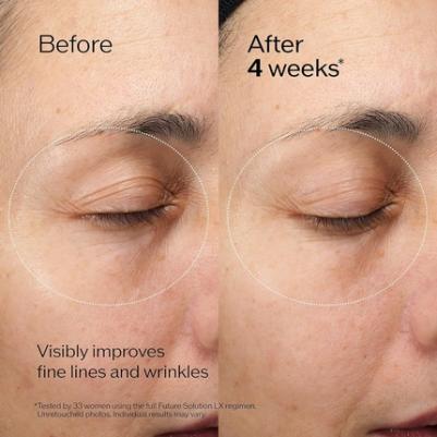 Крем для глаз Крем для восстановления кожи контура глаз и губ S Future Solution LX 17 – фото 3