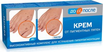 До и после Крем против пигментных пятен 50 мл