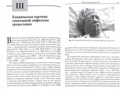 Абакумов Михаил Михайлович, Шамба Х. Л. Спонтанная эмфизема средостения. Клиника, диагностика, лечение – фото 1