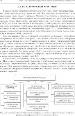 Александров Михаил Всеволодович, Чикуров Александр Андреевич, Топоркова Ольга Александровна. Нейрофизиологический интраоперационной мониторинг – фото 1