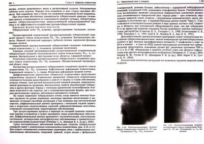 Баринов Владимир Семенович, Мальченко Оксана Владимировна. Внелёгочный туберкулёз – фото 2