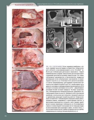 Барон Антонио, Нанмарк Ульф. Регенеративные технологии в стоматологии: Научно-практическое руководство – фото 5