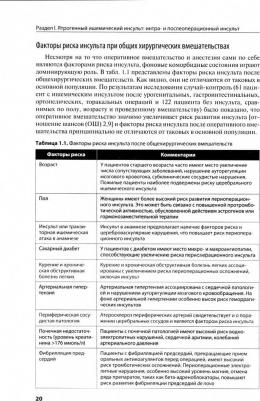 Цискаридзе А. Ятрогенный инсульт – фото 1