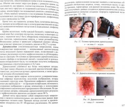 Довгалюк Андрей Захарович. Злокачественные новообразования кожи. Клиника, диагностика, лечение и вопросы – фото 2