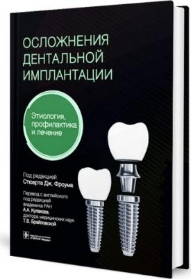 Фроум Стюарт Дж., Адольфи Дарио, Адольфи Маурицио Контар. Осложнения дентальной имплантации. Этиология, профилактика и лечение – фото 3