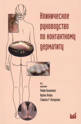 Клиническое руководство по контактному дерматиту. Диагностика и лечение в зависимости от области поражения