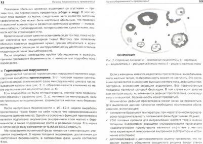 Панкова О.Ю. Невынашивание беременности – фото 2