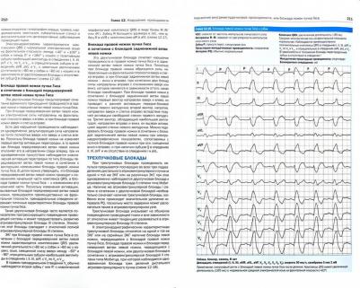 Сантилли Роберто А., Перего Мануэла. Электрокардиография собак и кошек. Формирование и интерпретация сердечного ритма – фото 3