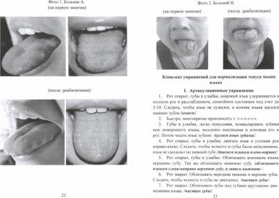 Щербакова Мария Михайловна. Программа восстановления дизартрии у больных с последствиями инсульта – фото 1