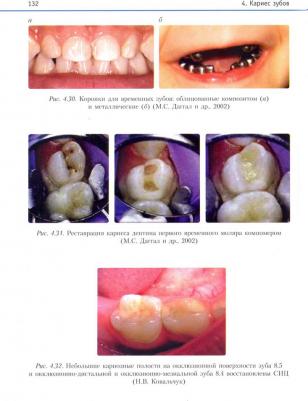 Терехова Тамара Николаевна, Белая Татьяна Григорьевна, Белик Людмила Петровна. Терапевтическая стоматология детского возраста. Учебник – фото 3