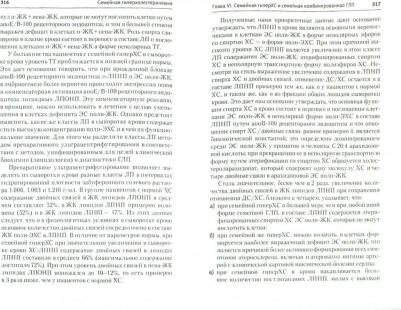 Титов Владимир Николаевич, Алиджанова Хафиза Гафуровна, Малышев Павел Прокопьевич. Семейная гиперхолестеринемия. Этиология, патогенез, диагностика и – фото 1