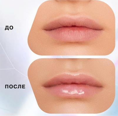 к_influence_блеск д/увел объема губ volume shot 6мл_03 полупрозр сер. 99F035003 – фото 2