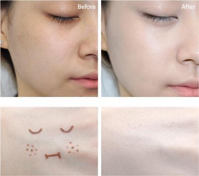BB-крем Super Plus Beblesh Balm Triple Functions Spf 30 – фото 4