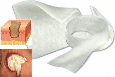 Sorbalgon T / Сорбалгон Т - тампонадная лента из волокон кальция-альгината – фото 5
