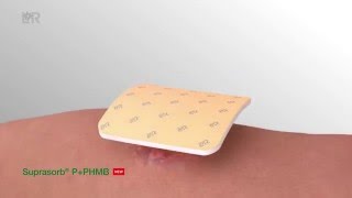 Suprasorb P / Супрасорб П - полиуретановая неадгезивная губчатая повязка, 5x5 см – фото 1