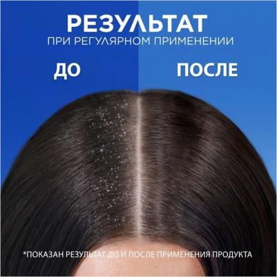 Шампунь против перхоти – фото 8