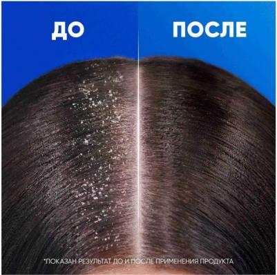 Шампунь Sports Fresh, против перхоти, 400 мл – фото 11