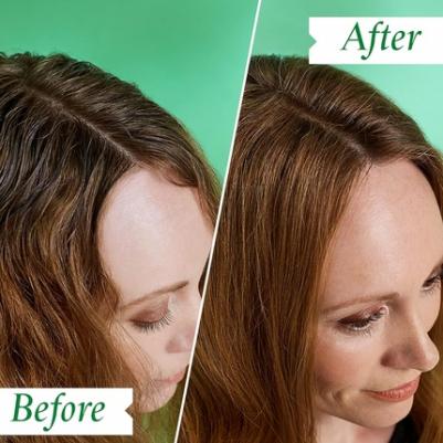 Шампунь Flaky/Itchy Scalp Shampoo против шелушения кожи головы, 75 мл – фото 3